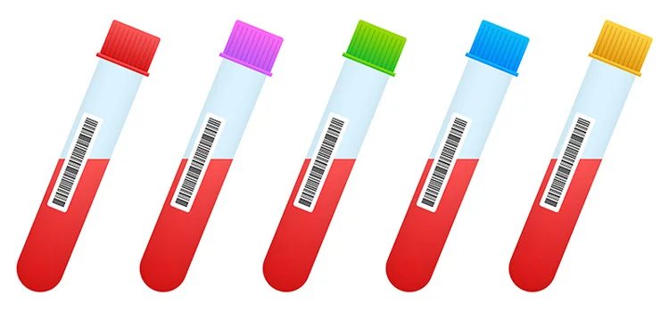 Blood samples of different individuals lined up