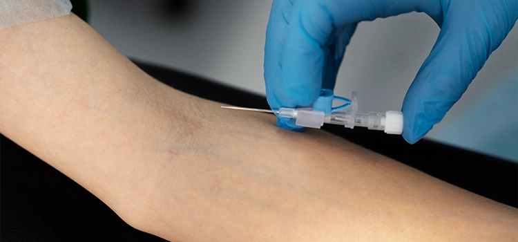 A nurse inserting an IV cannula into a forerm vein of the patient. 
