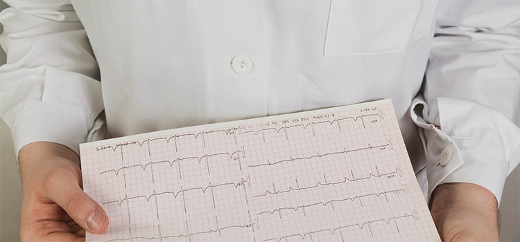 A healthcare professional examining an ECG report. 
