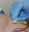 Phlebotomy Training Birmingham