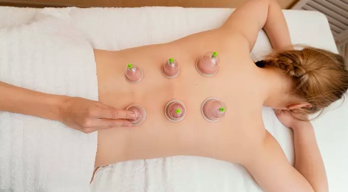 Professional Cupping Therapy Course Online