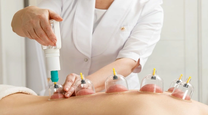 Cupping Therapy Course Online